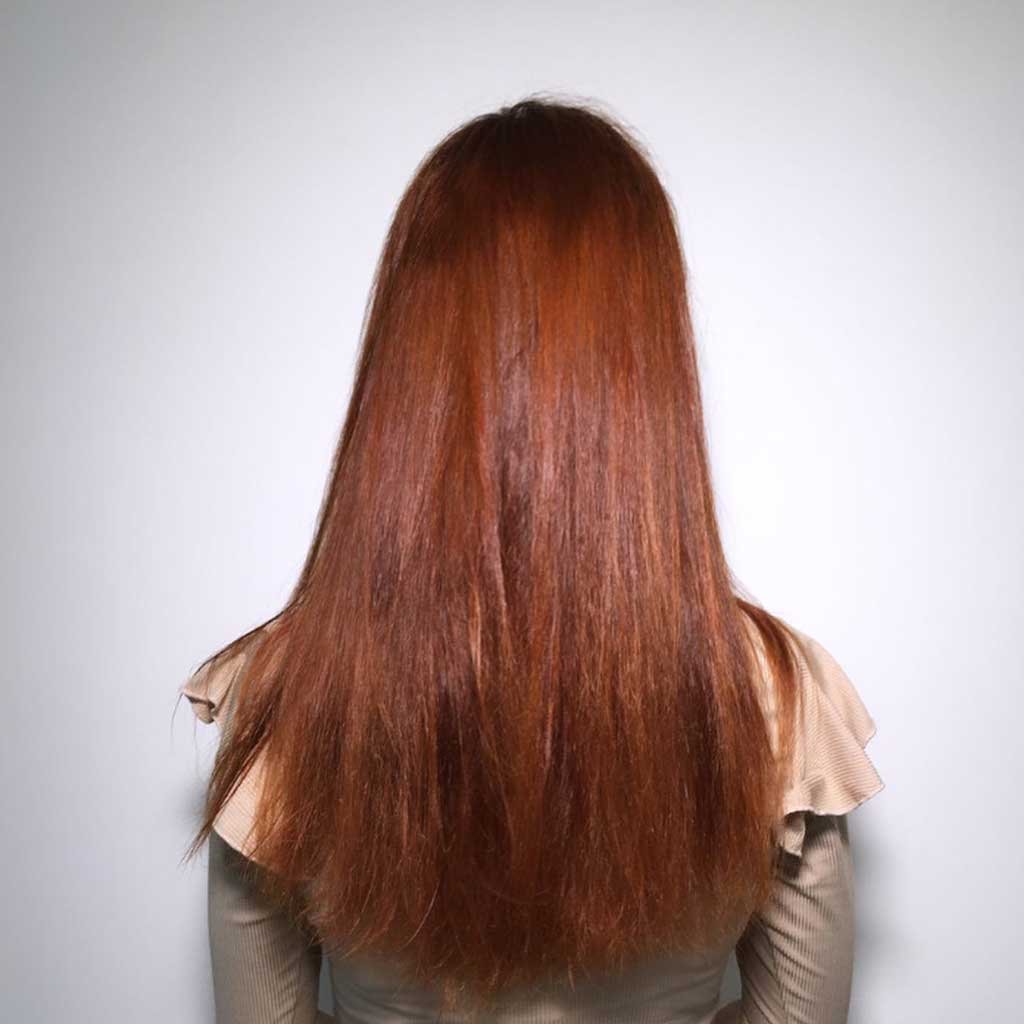 Antes